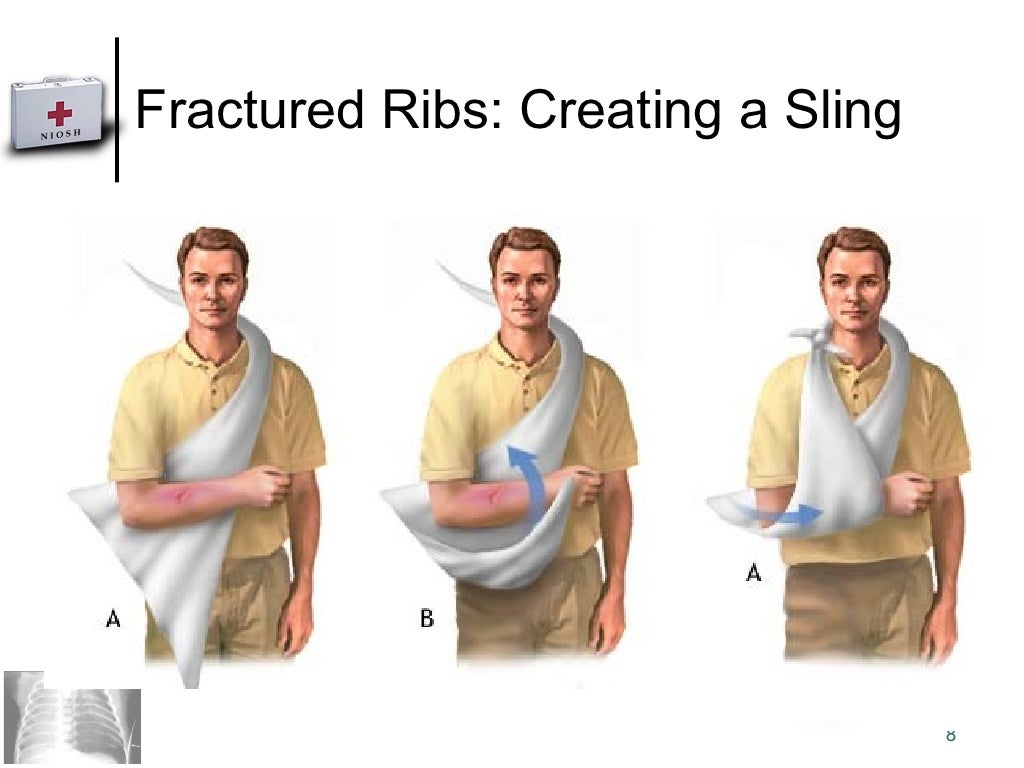 What Is A Flail Chest Injury First Aid For Free vrogue.co
