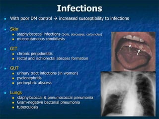 08 Complications of DM.ppt