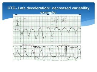 08 ctg isam ws | PPTX