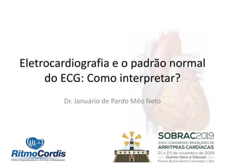 Eletrocardiografia e o padrão normal
do ECG: Como interpretar?
Dr. Januário de Pardo Mêo Neto
 