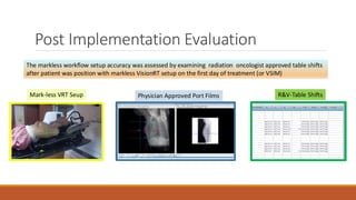 Post Implementation Evaluation
The markless workflow setup accuracy was assessed by examining radiation oncologist approved table shifts
after patient was position with markless VisionRT setup on the first day of treatment (or VSIM)
Mark-less VRT Seup Physician Approved Port Films R&V-Table Shifts
 