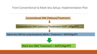 From Conventional to Mark-less Setup: Implementation Plan
Conventional SIM (Tattoos)/Treatment
Conventional SIM (tattoos)/Treatment+SGRT (AlignRT)
Tattoo-less SIM but using temporary Marks / Treatment + SGRT(AlignRT)
Mark-less SIM/ Treatment + SGRT(AlignRT)
 