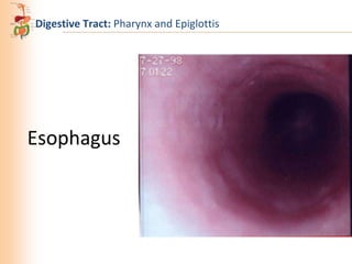 Digestive Tract: Pharynx and Epiglottis

Esophagus

 