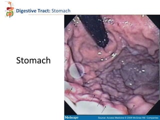Digestive Tract: Stomach

Stomach

 