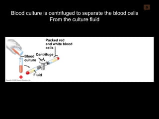 0 Packed red and white blood cells Centrifuge Blood culture Fluid 1 Blood culture is centrifuged to separate the blood cells From the culture fluid 