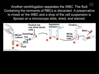 0 Packed red and white blood cells Centrifuge Blood culture Fluid 1 Hypotonic solution 2 3 Fixative White blood cells Stain Another centrifugation separates the WBC. The fluid Containing the remnants of RBCs is discarded. A preservative Is mixed w/ the WBC and a drop of the cell suspension is Spread on a microscope slide, dried, and stained. 