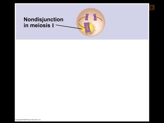 0 Nondisjunction in meiosis  I 