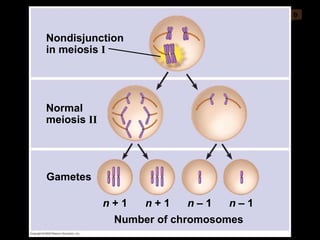 0 Nondisjunction in meiosis  I Normal meiosis  II n  + 1 Gametes Number of chromosomes n  + 1 n  – 1 n  – 1 