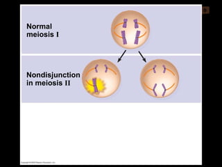 0 Nondisjunction in meiosis  II Normal meiosis  I 