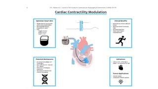 Chronic Heart Failure Device Management_ | PPTX