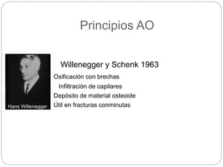 Principios AO
Willenegger y Schenk 1963
Osificación con brechas
Infiltración de capilares
Depósito de material osteoide
Út...