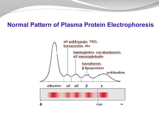 Normal Pattern of Plasma Protein Electrophoresis
 