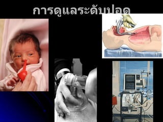 การดูแลระดับปอด 
