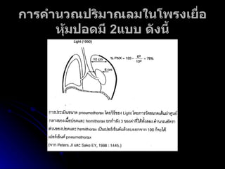 การคำนวณปริมาณลมในโพรงเยื่อหุ้มปอดมี  2 แบบ ดังนี้ 