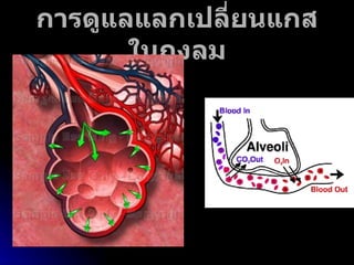 การดูแลแลกเปลี่ยนแกสในถุงลม 