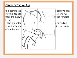 Forces acting on hip
To describe the forces acting on the hip joint, the body weight
may be depicted as a load applied to a lever arm extending
from the body’s center of gravity to the center of the femoral
head.
• The abductor musculature, acting on lever arm extending
from the lateral aspect of the greater trochanter to the center
of the femoral head.
 