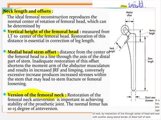 FEMORAL COMPONENTS
• The primary function of the femoral component is the
replacement of the femoral head and neck after resection
of the arthritic or necrotic segment.
• The ultimate goal of a biomechanically sound, stable hip
joint is accomplished by careful attention to restoration of
the normal center of rotation of the femoral head.
• This location is determined by three factors:
• (1) vertical height (vertical offset),
• (2) medial offset (horizontal offset or, simply, offset), and
• (3) version of the femoral neck (anterior offset) (Fig. 3-6).
 