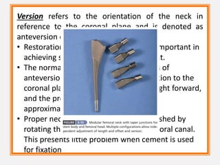 Version refers to the orientation of the neck in
reference to the coronal plane and is denoted as
anteversion or retroversion.
• Restoration of femoral neck version is important in
achieving stability of the prosthetic joint.
• The normal femur has 10 to 15 degrees of
anteversion of the femoral neck in relation to the
coronal plane when the foot faces straight forward,
and the prosthetic femoral neck should
approximate this.
• Proper neck version usually is accomplished by
rotating the component within the femoral canal.
This presents little problem when cement is used
for fixation
 