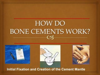 Initial Fixation and Creation of the Cement Mantle
 