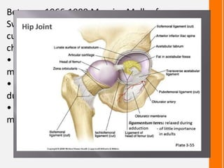Between 1966-1988,Maurice Muller from
Switzerland developed a plastic acetabular
cup with a 32 mm diameter
chromiumcobaltmolybdenum femoral head.
• In 1964,Peter Ring began using metal-to-
metal components without cement,
• concept of modular prosthesis developed
during 1970
• cementless prostheses came in to picture by
mid 1980
 