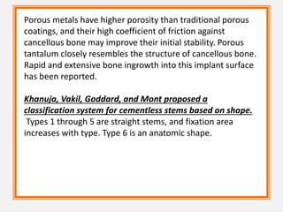 Porous metals have higher porosity than traditional porous
coatings, and their high coefficient of friction against
cancellous bone may improve their initial stability. Porous
tantalum closely resembles the structure of cancellous bone.
Rapid and extensive bone ingrowth into this implant surface
has been reported.
Khanuja, Vakil, Goddard, and Mont proposed a
classification system for cementless stems based on shape.
Types 1 through 5 are straight stems, and fixation area
increases with type. Type 6 is an anatomic shape.
 
