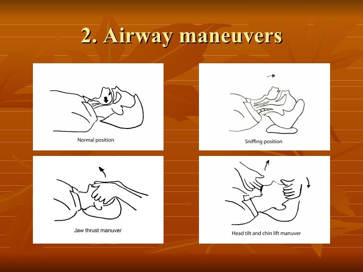 TAEM10Airway care