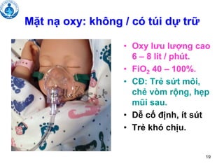 19
Mặt nạ oxy: không / có túi dự trữ
• Oxy lưu lượng cao
6 – 8 lít / phút.
• FiO2 40 – 100%.
• CĐ: Trẻ sứt môi,
chẻ vòm rộng, hẹp
mũi sau.
• Dễ cố định, ít sút
• Trẻ khó chịu.
 