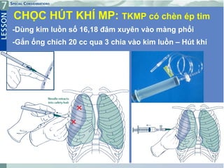 CHỌC HÚT KHÍ MP: TKMP có chèn ép tim
-Dùng kim luồn số 16,18 đâm xuyên vào màng phổi
-Gắn ống chích 20 cc qua 3 chia vào kim luồn – Hút khí
 