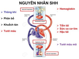 NGUYÊN NHÂN SHH
➢ Thông khí
➢ Phân bố
➢ Khuếch tán
➢ Tưới máu
➢ Hemoglobin
➢ Tiền tải
➢ Sức co cơ tim
➢ Hậu tải
➢ Tưới máu mô
 