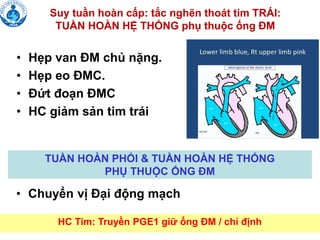 Suy tuần hoàn cấp: tắc nghẽn thoát tim TRÁI:
TUẦN HOÀN HỆ THỐNG phụ thuộc ống ĐM
• Hẹp van ĐM chủ nặng.
• Hẹp eo ĐMC.
• Đứt đoạn ĐMC
• HC giảm sản tim trái
HC Tim: Truyền PGE1 giữ ống ĐM / chỉ định
TUẦN HOÀN PHỔI & TUẦN HOÀN HỆ THỐNG
PHỤ THUỘC ỐNG ĐM
• Chuyển vị Đại động mạch
 