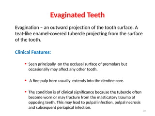 08) TOOTH ABNORMALITIES in dentistry bhjg | PPTX