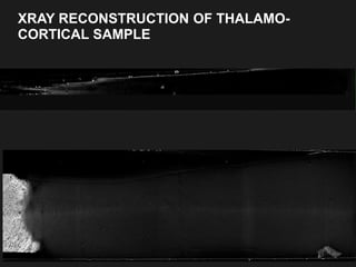 XRAY RECONSTRUCTION OF THALAMO-
CORTICAL SAMPLE
3
 