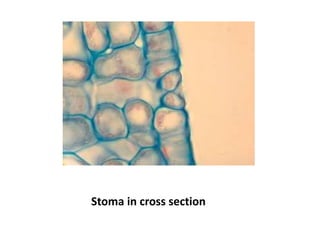Stoma in cross section
 