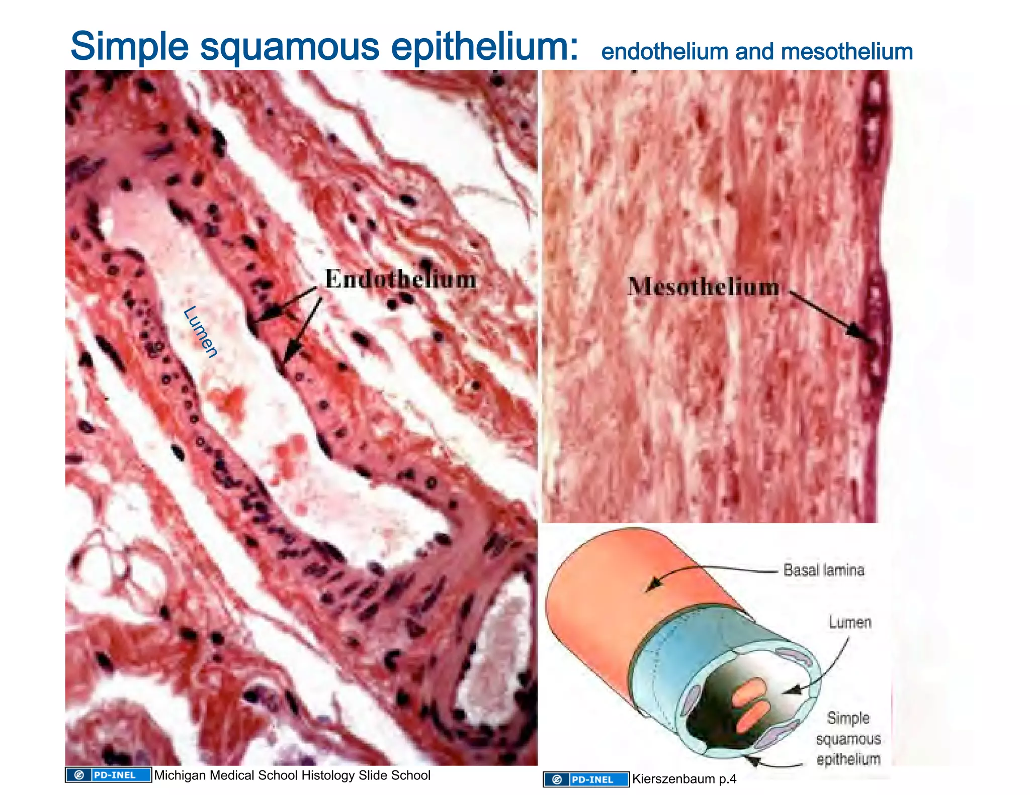 Simple squamous epithelium:  endothelium and mesothelium
                                                        




     Michigan Medical School Histology Slide School   Kierszenbaum p.4
 