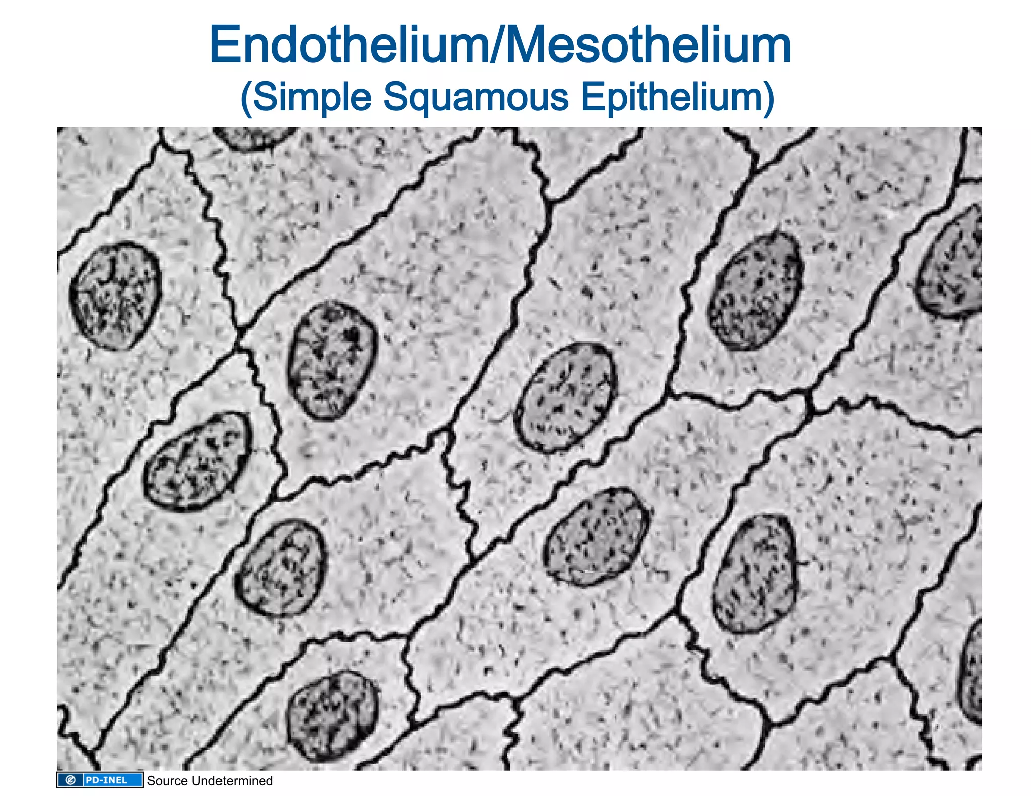 Endothelium/Mesothelium 
                                 
                                         
             (Simple Squamous Epithelium)




Source Undetermined
 