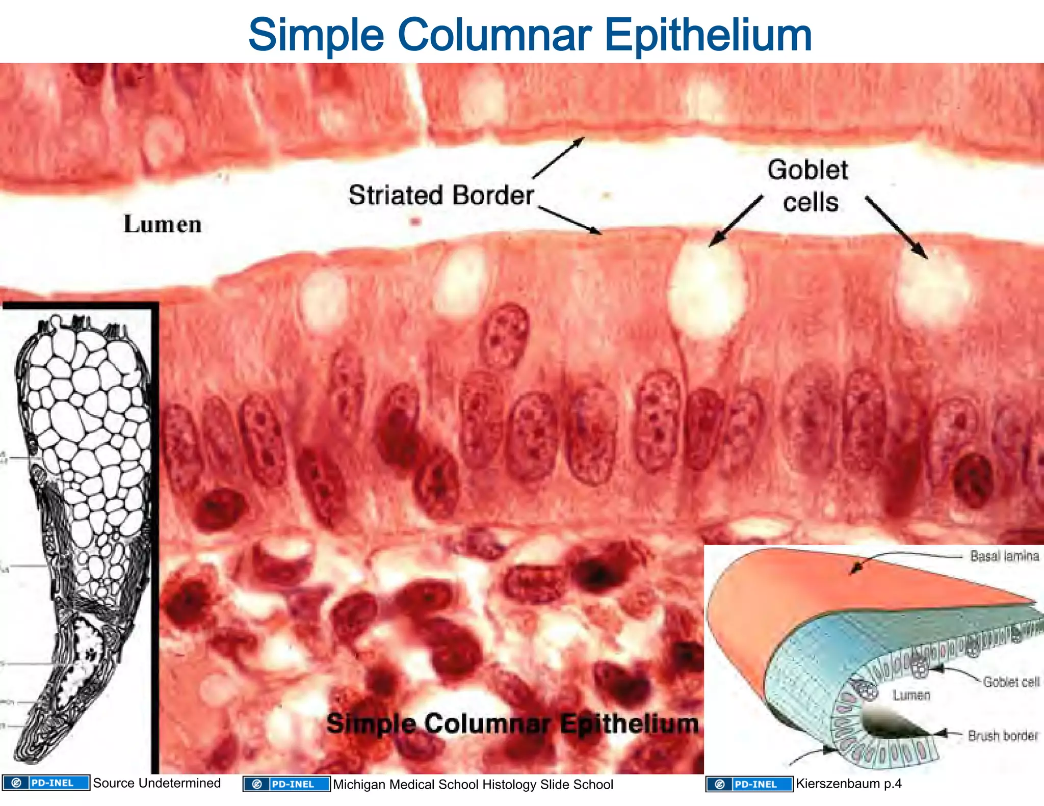 Simple Columnar Epithelium 




Source Undetermined       Michigan Medical School Histology Slide School   Kierszenbaum p.4
 