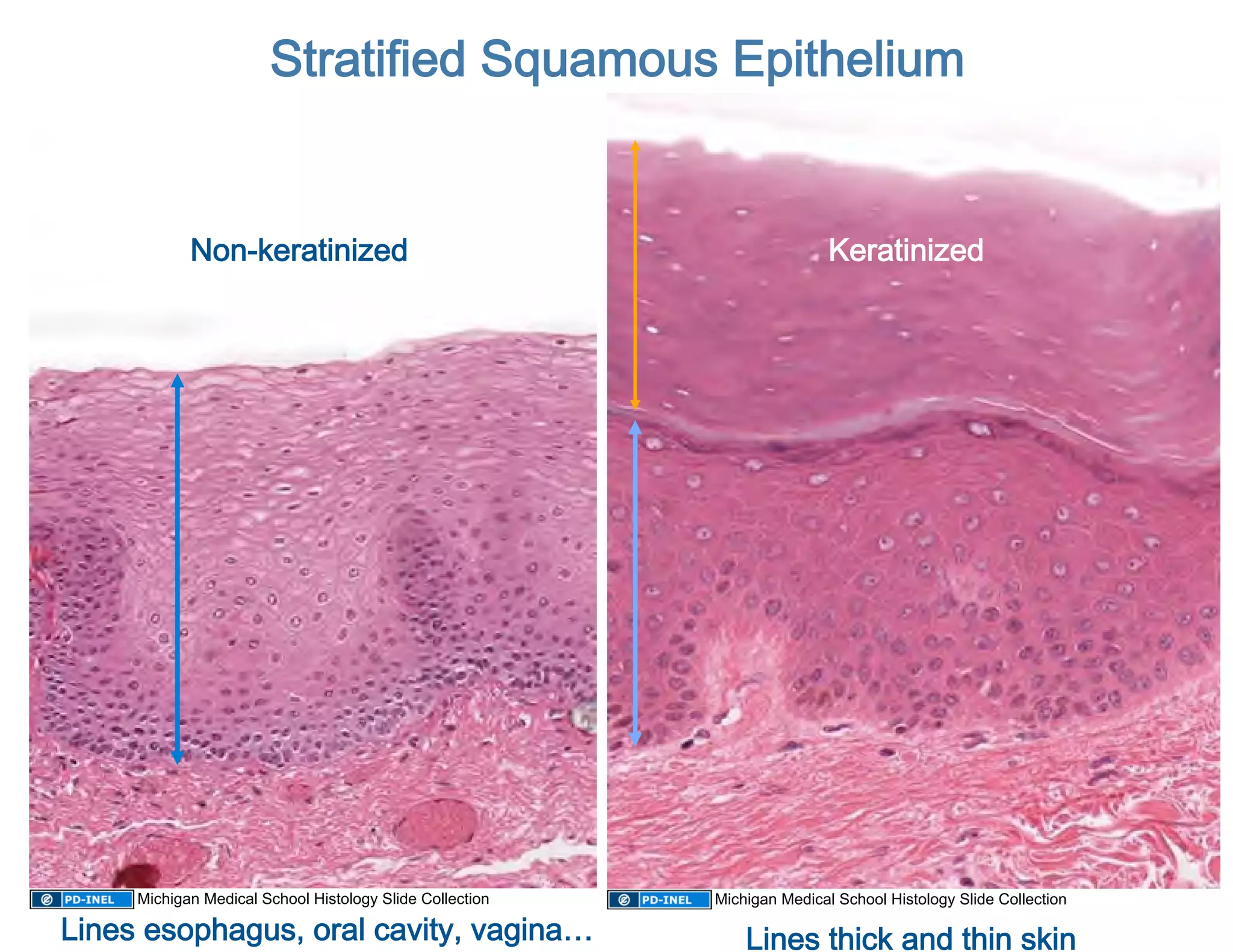 Stratified Squamous Epithelium 


            Non-keratinized                                               Keratinized 




     Michigan Medical School Histology Slide Collection   Michigan Medical School Histology Slide Collection

Lines esophagus, oral cavity, vagina…                         Lines thick and thin skin 
 