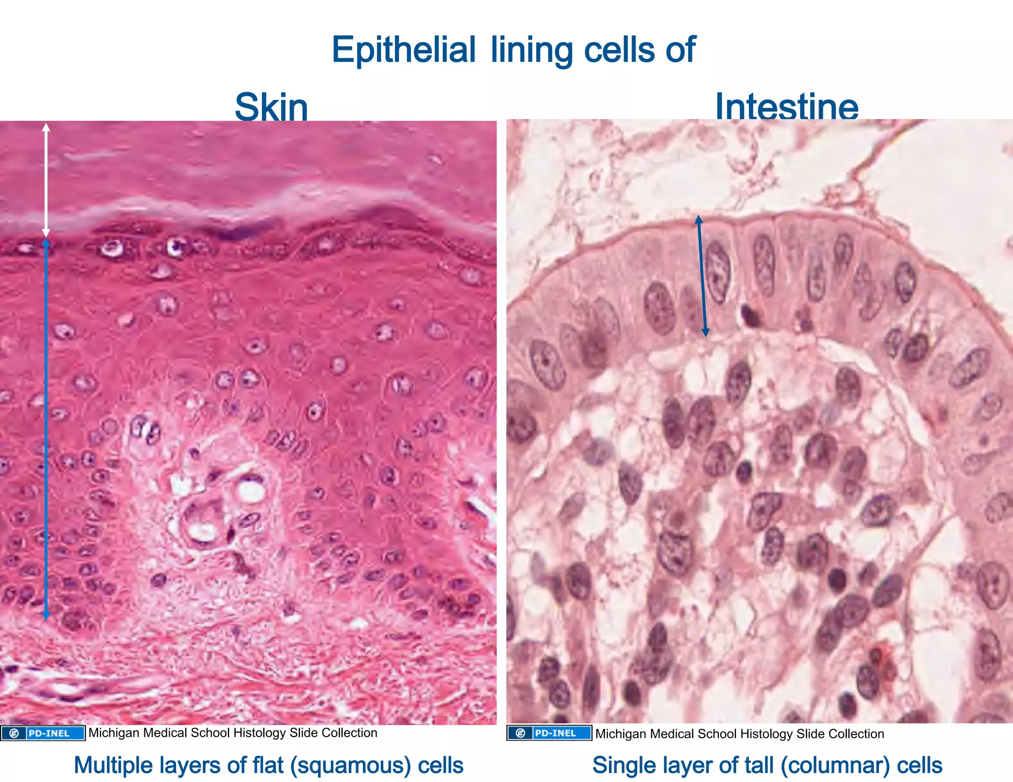                       Epithelial lining cells of  
               Skin                                      Intestine 




    Michigan Medical School Histology Slide Collection   Michigan Medical School Histology Slide Collection

   Multiple layers of flat (squamous) cells
                                                         Single layer of tall (columnar) cells
                                                                                              
 