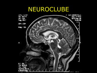NEUROCLUBE 