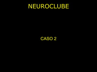 NEUROCLUBE CASO 2 