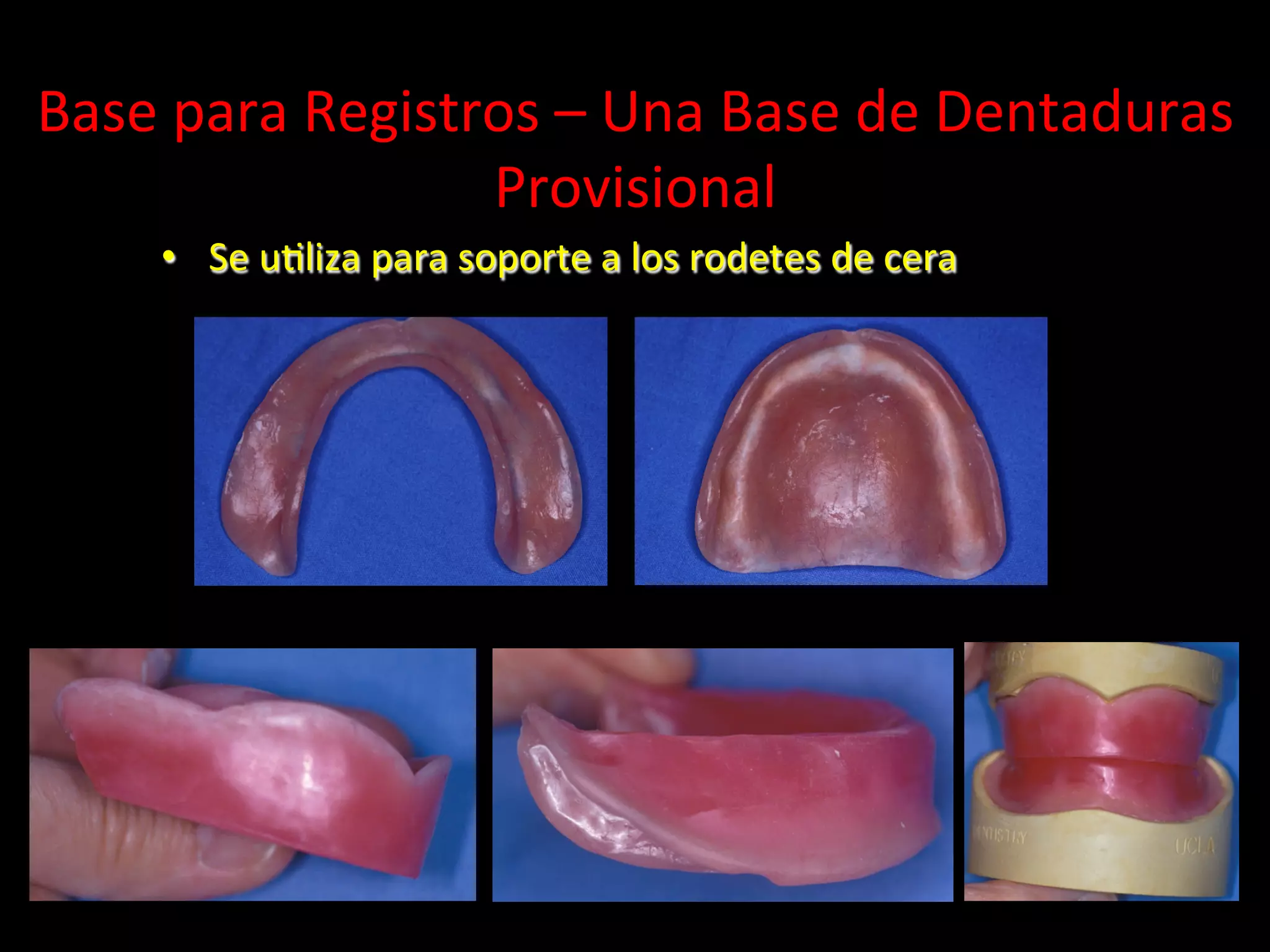 09. base de registro y fabricacion del rodete de cera | PDF | Dental ...
