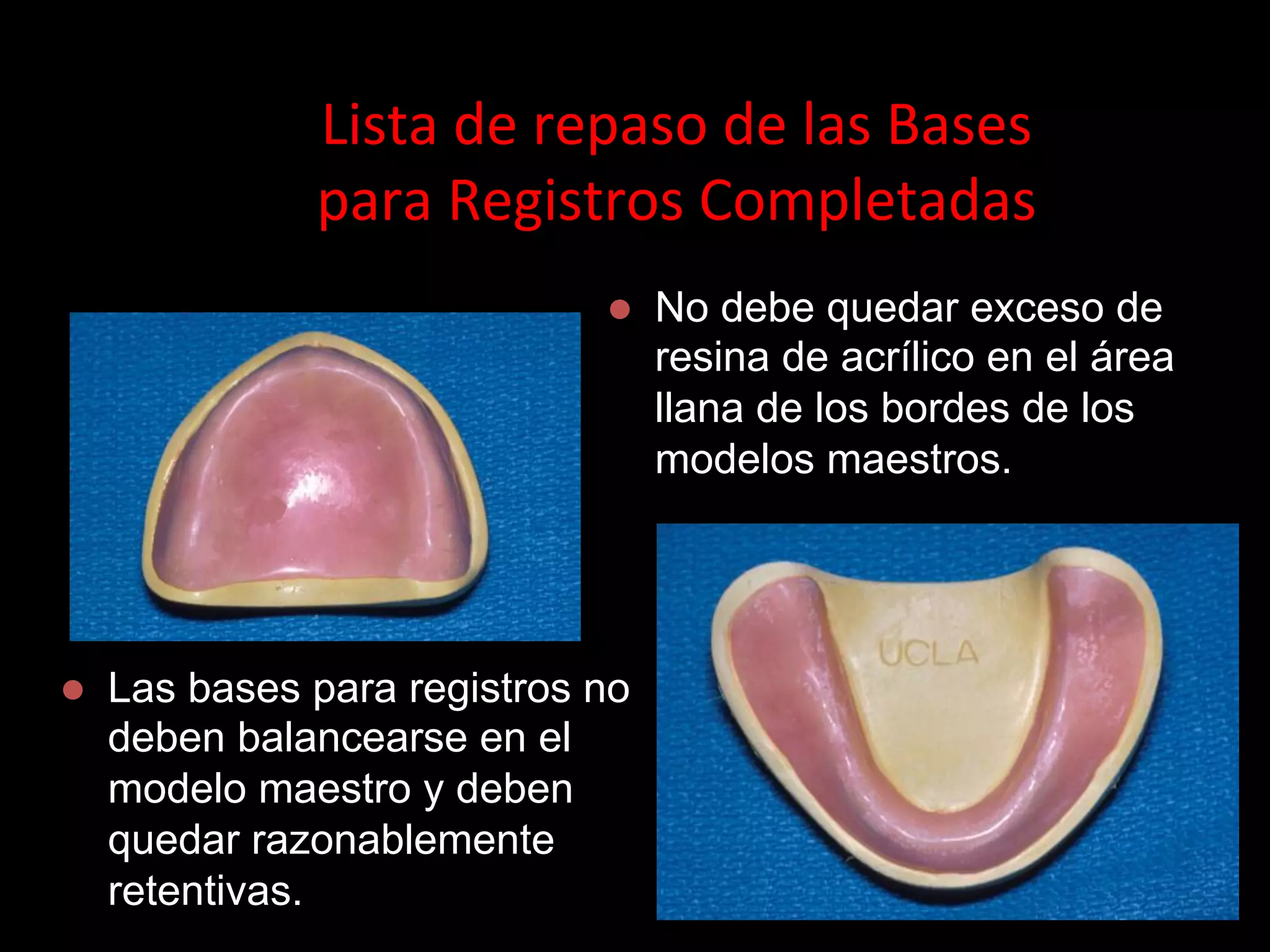 09. base de registro y fabricacion del rodete de cera | PDF | Dental ...