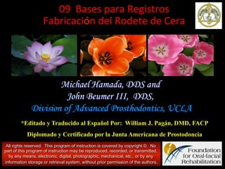 09	
  	
  Bases	
  para	
  Registros	
  	
  
Fabricación	
  del	
  Rodete	
  de	
  Cera	
  

	
  	
  

Michael Hamada, DDS and
John Beumer III, DDS,
Division of Advanced Prosthodontics, UCLA
*Editado y Traducido al Español Por: William J. Pagán, DMD, FACP
Diplomado y Certificado por la Junta Americana de Prostodoncia
All rights reserved. This program of instruction is covered by copyright ©. No
part of this program of instruction may be reproduced, recorded, or transmitted,
by any means, electronic, digital, photographic, mechanical, etc., or by any
information storage or retrieval system, without prior permission of the authors.

 