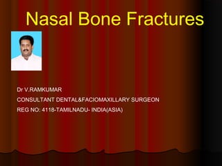 Nasal Bone Fractures 
Dr V.RAMKUMAR 
CONSULTANT DENTAL&FACIOMAXILLARY SURGEON 
REG NO: 4118-TAMILNADU- INDIA(ASIA) 
 