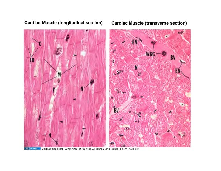 pix Cardiac Skeletal Muscle Tissue Microscope 09 15 08 muscle tissue