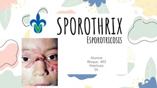 Esporotricosis
Alumna:
Bloque: 402
Matrícula:
Dr.
SPOROTHRIX
 