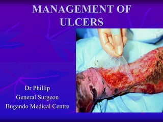 MANAGEMENT OF
ULCERS
Dr Phillip
General Surgeon
Bugando Medical Centre
 