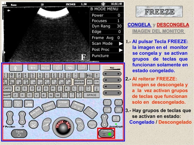 09.INSTRUMENTACION DEL ECOGRAFO DP 2020.pptx