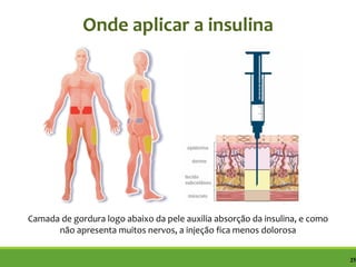 25
Onde aplicar a insulina
Camada de gordura logo abaixo da pele auxilia absorção da insulina, e como
não apresenta muitos nervos, a injeção fica menos dolorosa
 