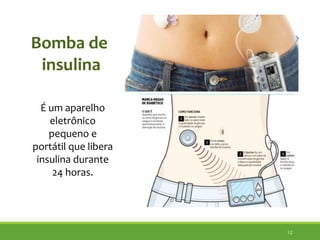 12
Bomba de
insulina
É um aparelho
eletrônico
pequeno e
portátil que libera
insulina durante
24 horas.
 